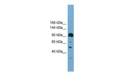 Western Blot: Gemin 3 Antibody [NBP3-10425] - WB Suggested Anti-Gemin 3 Antibody Titration: 0.2-1 ug/ml. Positive Control: NIH/3T3 cell lysate